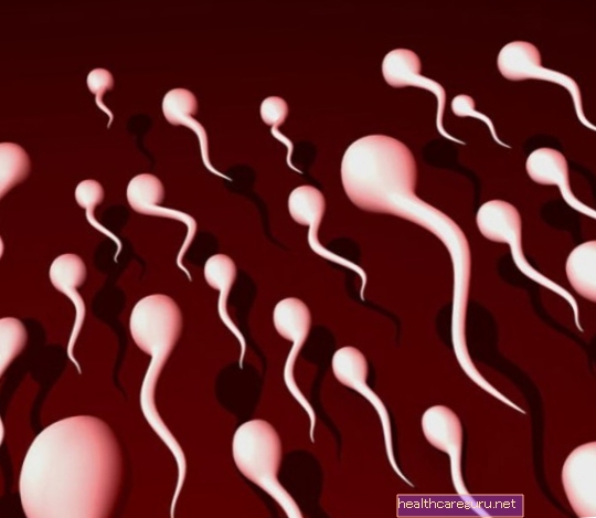 Apa yang menyebabkan sperma menjadi kekuningan dan apa yang harus dilakukan