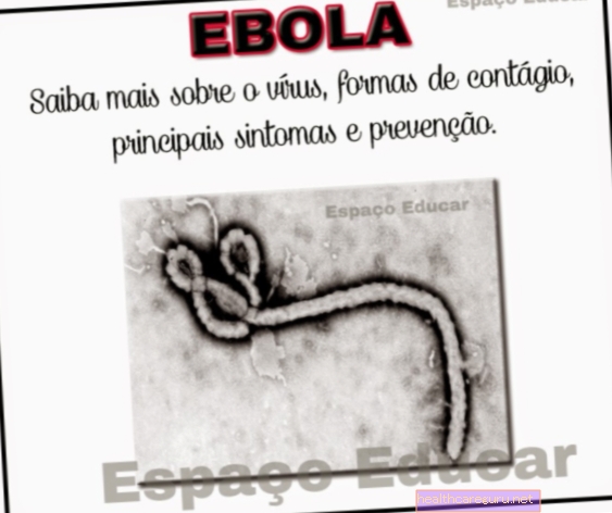 الأعراض الرئيسية للإيبولا