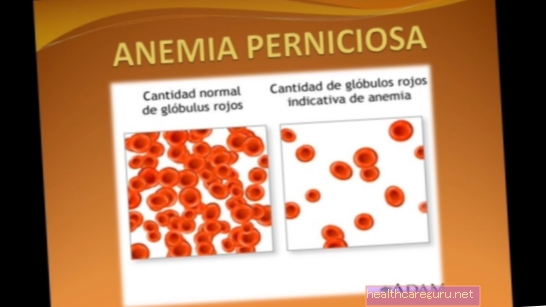 Příznaky perniciózní anémie