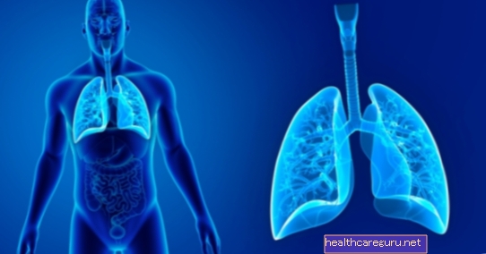 Tuberkulosis: 7 gejala yang mungkin menunjukkan jangkitan
