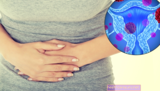 Kan endometriose bli fett?