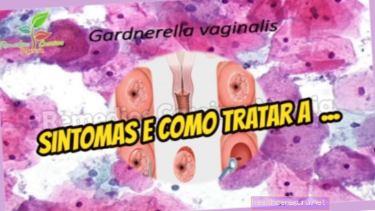Gardnerella vaginalis: gejala, cara mendapatkannya dan rawatan