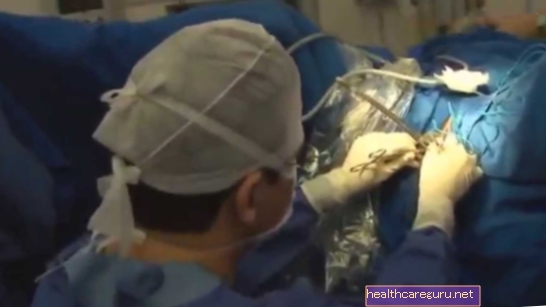 Kirurgiline hüsteroskoopia: mis see on, kuidas seda tehakse ja taastumine